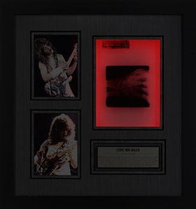 Edward Van Halen 1982 Framed & Lighted Fractured Wrist X-Ray Display