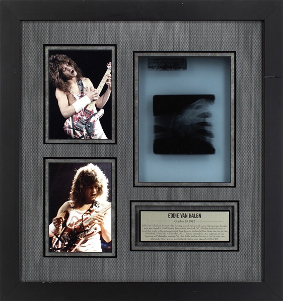 Edward Van Halen 1982 Framed & Lighted Fractured Wrist X-Ray Display